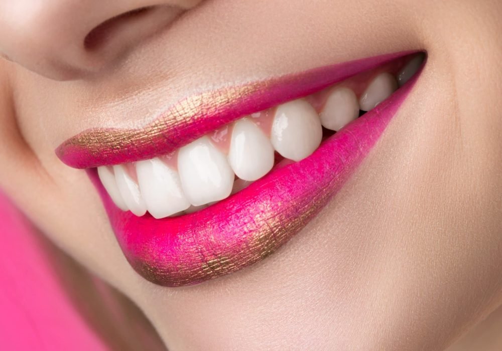 iStock-673891542 (1) Estética dental y blanqueamiento